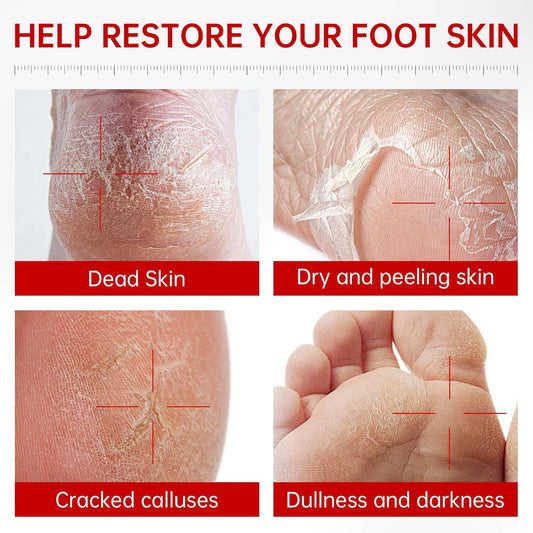 Foot Peeling Mask, Hydrating Exfoliating Foot Mask for Dry Cracked Feet, Callus Remover & Cracked Heel Repair & Foot Care (7 Pack)